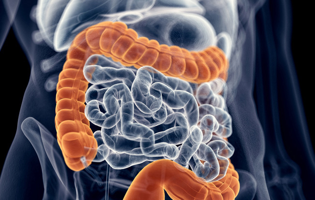 Fasting-mimicking diet holds promise for treating people with inflammatory bowel disease, USC study finds