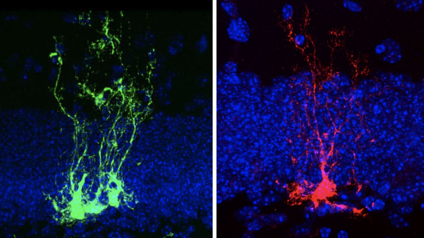 Neural stem cell clones in young (green) and old (red) mouse brains. (Image credit by Albina Ibrayeva/Bonaguidi Lab).