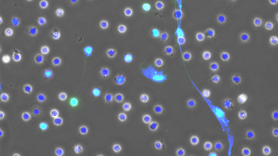 Microscopic view of a cell featuring blue dots throughout its structure